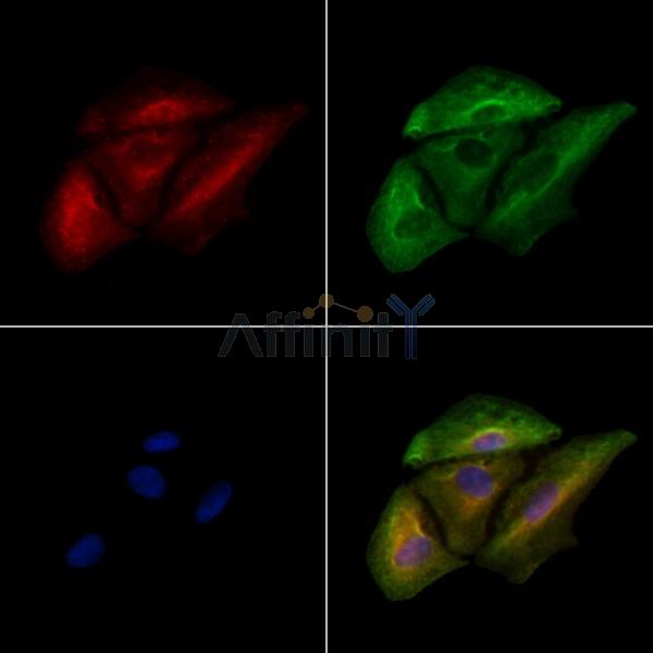 GIT1 Antibody - DF8660 staining A549 cells by IF/ICC.