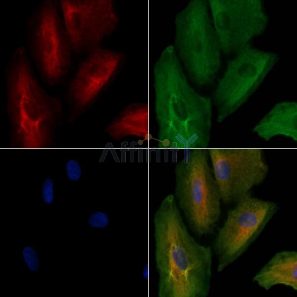 KLHL3 Antibody - DF8672 staining A549 cells by IF/ICC.