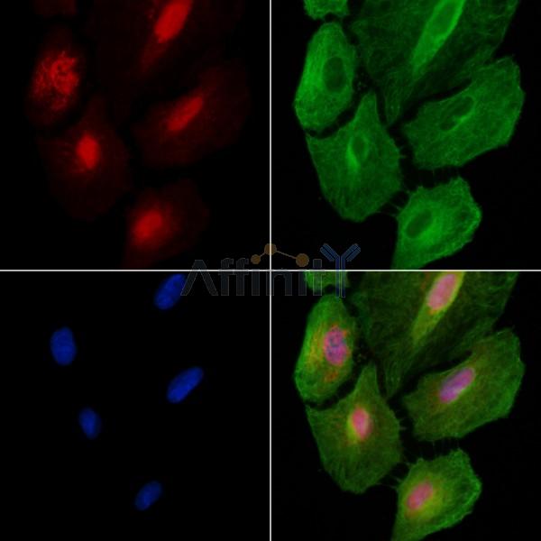 ARI1A Antibody - DF8752 staining A549 cells by IF/ICC.