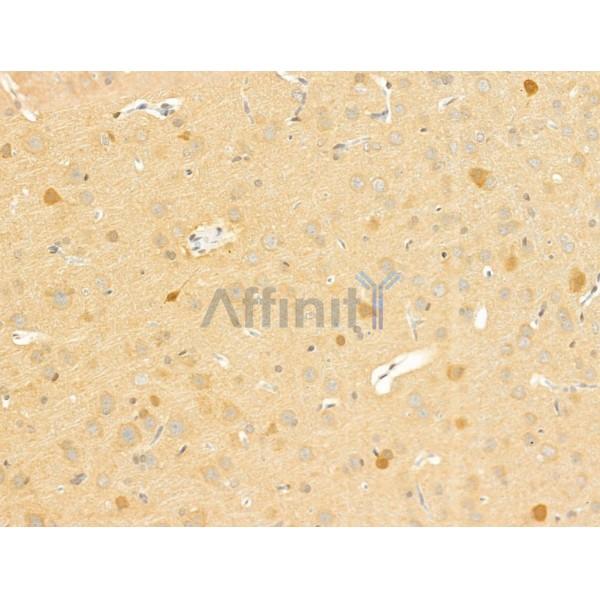 MRP Antibody - DF8801 at 1/100 staining Rat brain tissue by IHC-P.