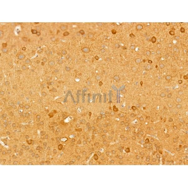 MRP Antibody - DF8801 at 1/100 staining Mouse brain tissue by IHC-P.