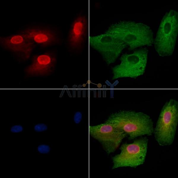 SERF2 Antibody - DF8810 staining A549 cells by IF/ICC.