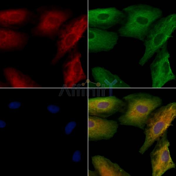AKAP12 Antibody - DF8813 staining A549 cells by IF/ICC.