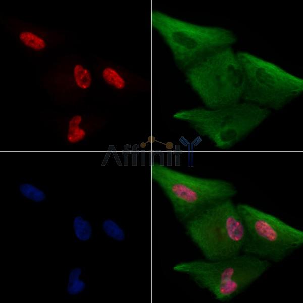 EMX2 Antibody - DF8815 staining A549 cells by IF/ICC.