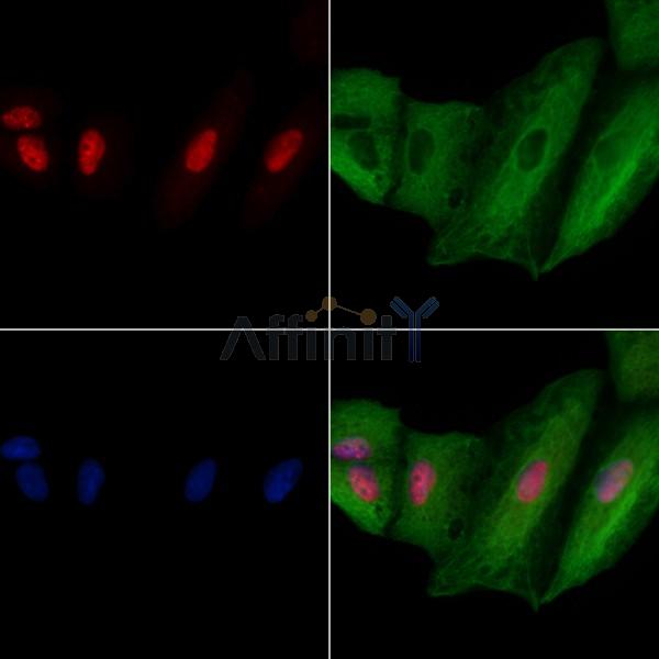 SART3 Antibody - DF8829 staining A549 cells by IF/ICC.