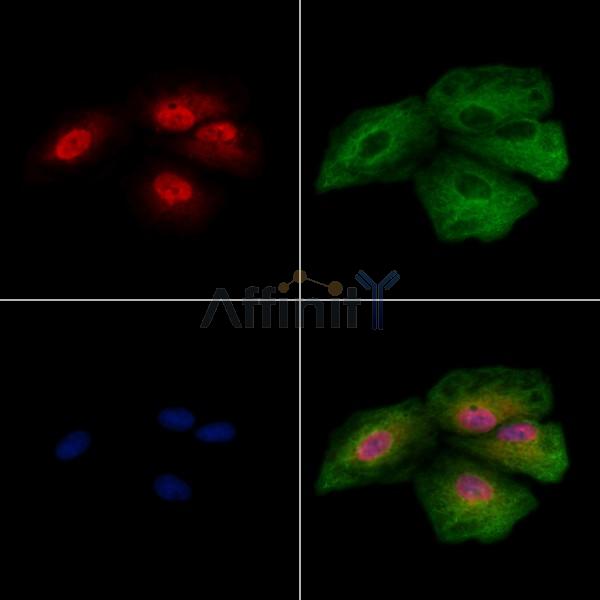 THRAP3 Antibody - DF8893 staining A549 cells by IF/ICC.