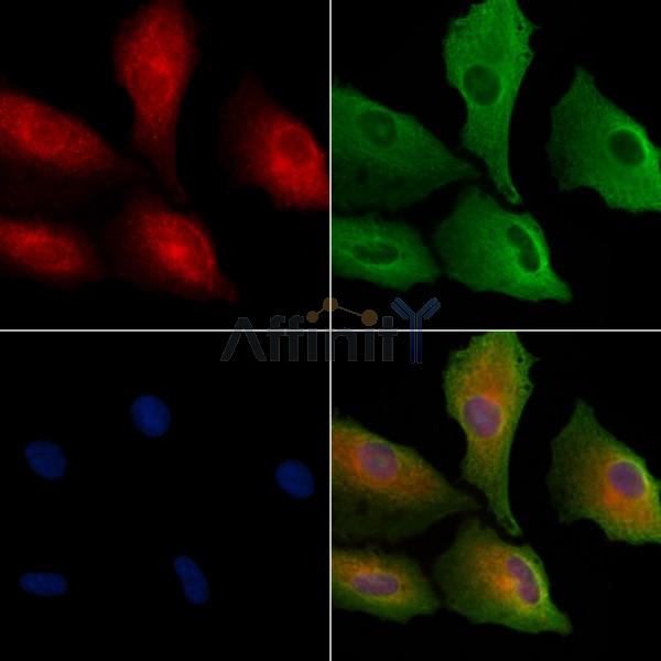 CRLF3 Antibody - DF8931 staining A549 cells by IF/ICC.