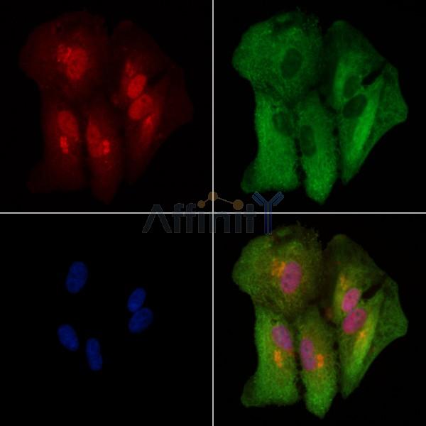 Cytokeratin 9 Antibody - DF9001 staining A549 cells by IF/ICC.