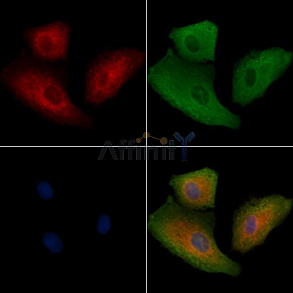 K1H2 Antibody - DF9003 staining A549 cells by IF/ICC.
