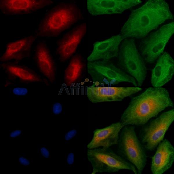 ALKBH7 Antibody - DF9074 staining A549 cells by IF/ICC.