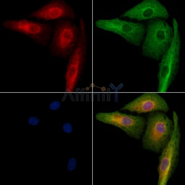 ACBD5 Antibody - DF9152 staining A549 cells by IF/ICC.