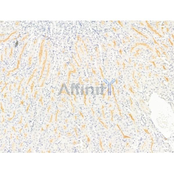 SLC4A9 Antibody - DF9214 at 1/100 staining Mouse kidney tissue by IHC-P.