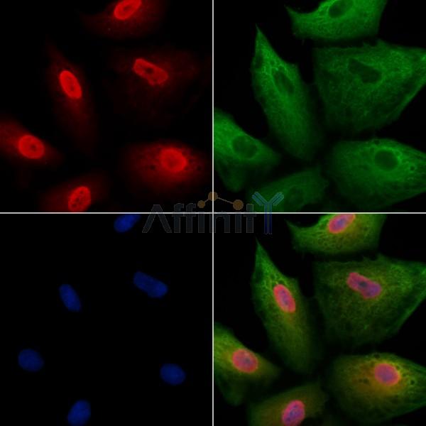 PCP4 Antibody - DF9286 staining A549 cells by IF/ICC.
