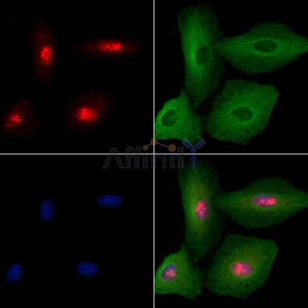 CEACAM19 Antibody - DF9344 staining A549 cells by IF/ICC.
