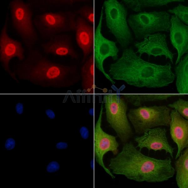DHRS1 Antibody - DF9434 staining A549 cells by IF/ICC.