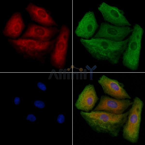 MARCH1 Antibody - DF9481 staining A549 cells by IF/ICC.