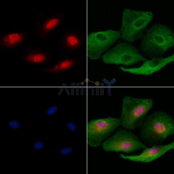 RNF41 Antibody - DF9486 staining A549 cells by IF/ICC.
