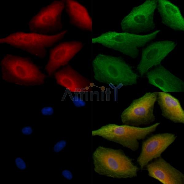 ENDOD1 Antibody - DF9497 staining A549 cells by IF/ICC.