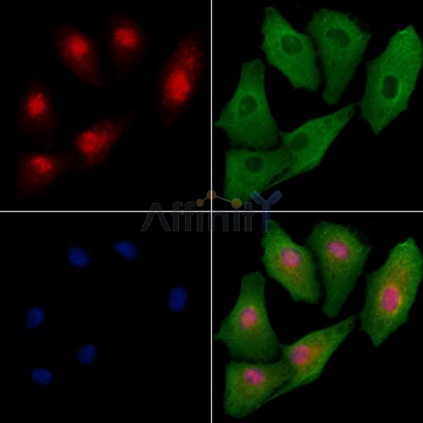 FNBP4 Antibody - DF9521 staining A549 cells by IF/ICC.
