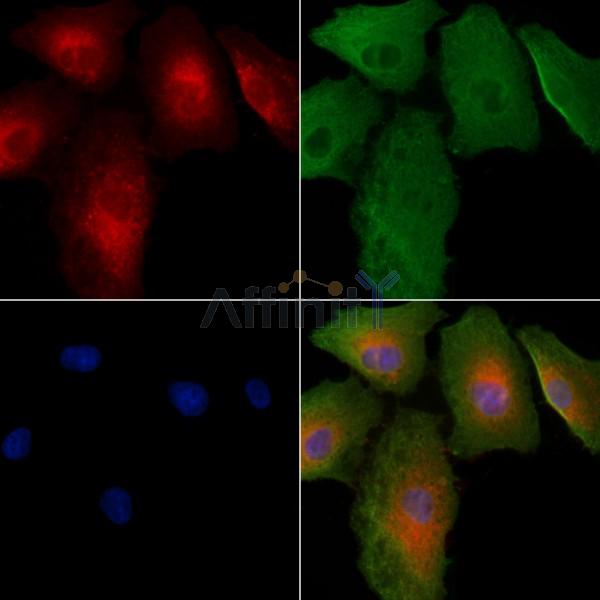 SAR1A Antibody - DF9554 staining A549 cells by IF/ICC.