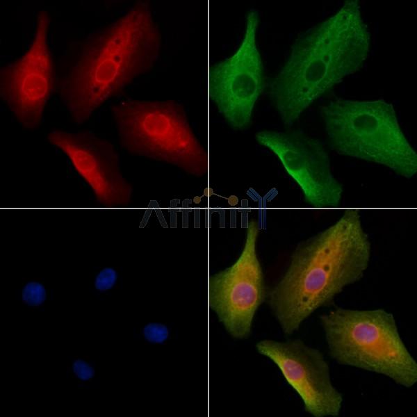 MSS4 Antibody - DF9555 staining A549 cells by IF/ICC.