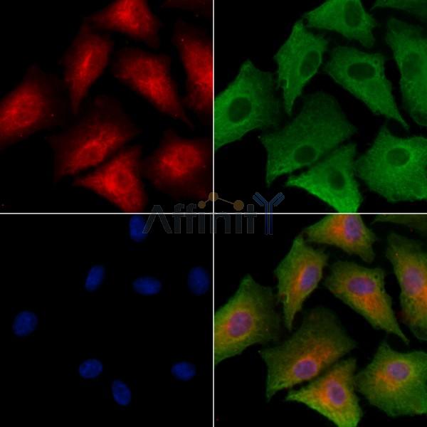HGFAC Antibody - DF9570 staining A549 cells by IF/ICC.