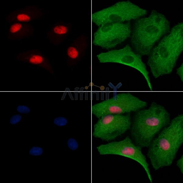 MED29 Antibody - DF9616 staining A549 cells by IF/ICC.