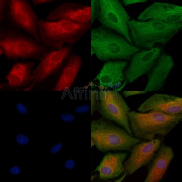 MYO16 Antibody - DF9656 staining A549 cells by IF/ICC.
