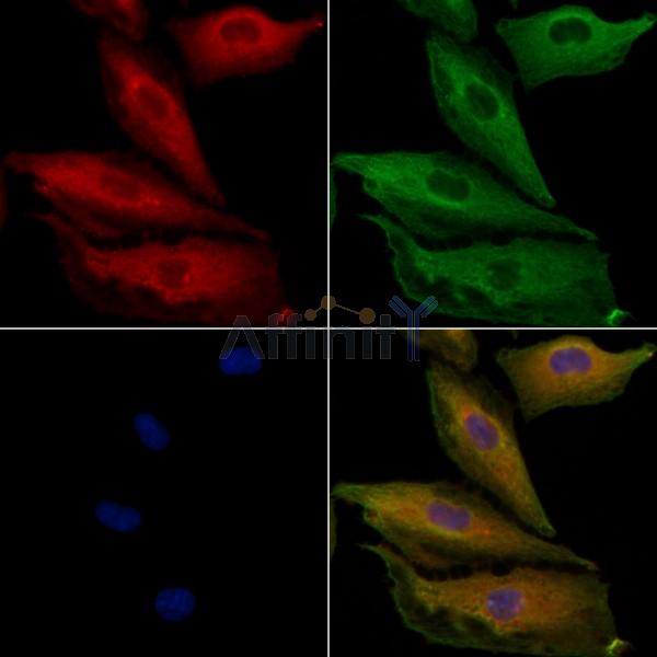 PPP1R3D Antibody - DF9780 staining A549 cells by IF/ICC.