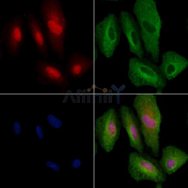 RHG25 Antibody - DF9859 staining A549 cells by IF/ICC.