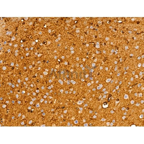 SHANK3 Antibody - DF9901 at 1/100 staining Mouse brain tissue by IHC-P.