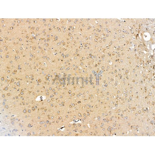 SHANK3 Antibody - DF9901 at 1/100 staining Rat brain tissue by IHC-P.