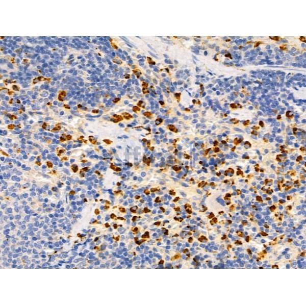 SHANK3 Antibody - DF9901 at 1/100 staining Rat spleen tissue by IHC-P.