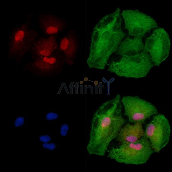 USP35 Antibody - DF9991 staining A549 cells by IF/ICC.