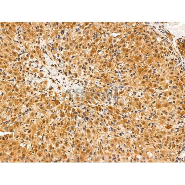 SENP8 Antibody - AF0279 at 1/100 staining Rat ovarian tissue by IHC-P.