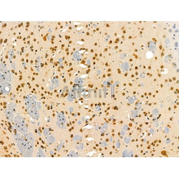 SENP8 Antibody - AF0279 at 1/100 staining Mouse brain tissue by IHC-P.