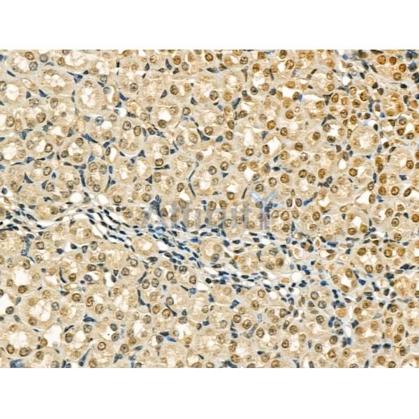 AKAP8 Antibody - AF0333 at 1/100 staining Mouse brain tissue by IHC-P.