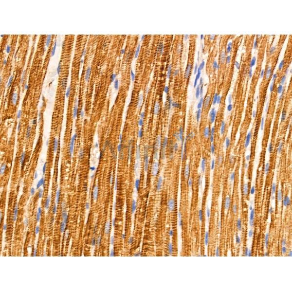 TRIM16 Antibody - AF0352 at 1/100 staining Rat heart tissue by IHC-P.