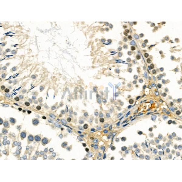 DMC1 Antibody - AF0378 at 1/100 staining Rat testis tissue by IHC-P.