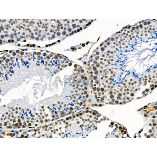 VPS72 Antibody - AF0508 at 1/100 staining Mouse testis tissue by IHC-P.