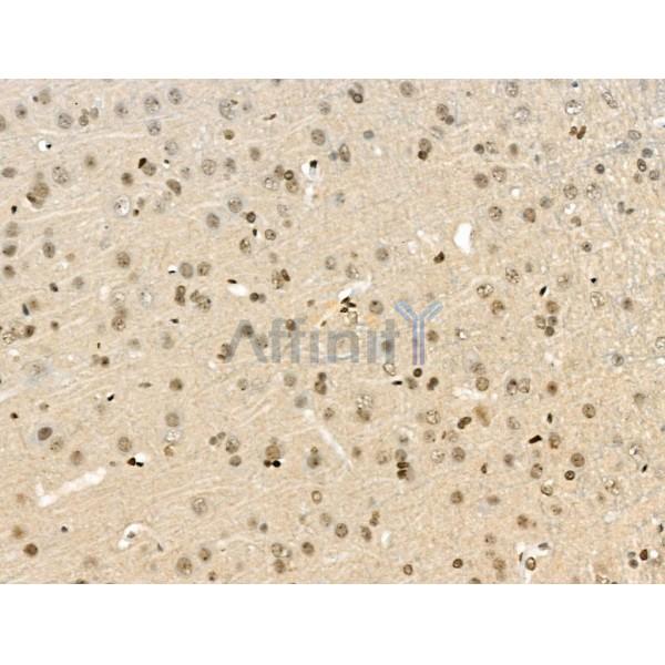 VPS72 Antibody - AF0508 at 1/100 staining Rat lung tissue by IHC-P.