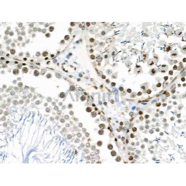 VPS72 Antibody - AF0508 at 1/100 staining Rat stomach tissue by IHC-P.