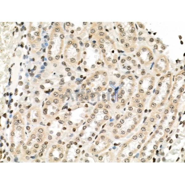 VPS72 Antibody - AF0508 at 1/100 staining Rat spleen tissue by IHC-P.