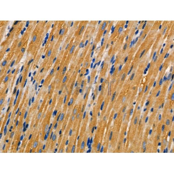 AKAP3 Antibody - AF0529 at 1/100 staining Rat heart tissue by IHC-P.