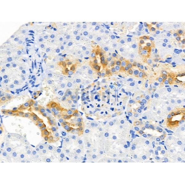 DDIT3/CHOP Antibody - AF0629 at 1/100 staining Rat kidney tissue by IHC-P.