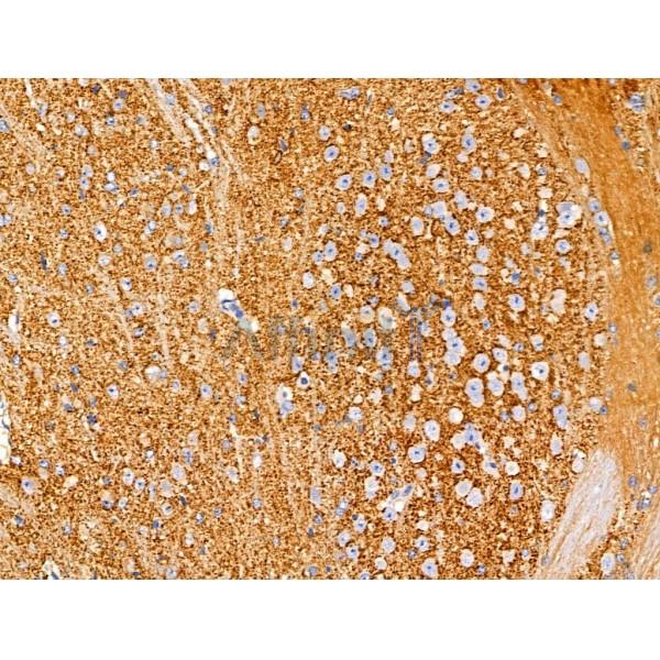 GAD1/2 Antibody - AF0711 at 1/100 staining Mouse brain tissue by IHC-P.