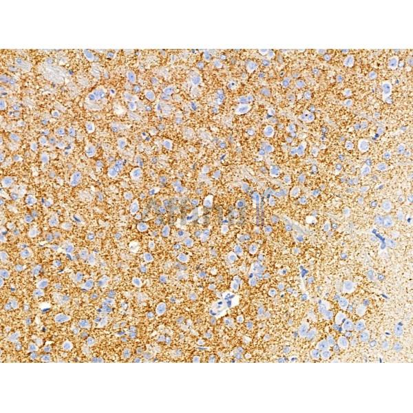 GAD1/2 Antibody - AF0711 at 1/100 staining Rat brain tissue by IHC-P.