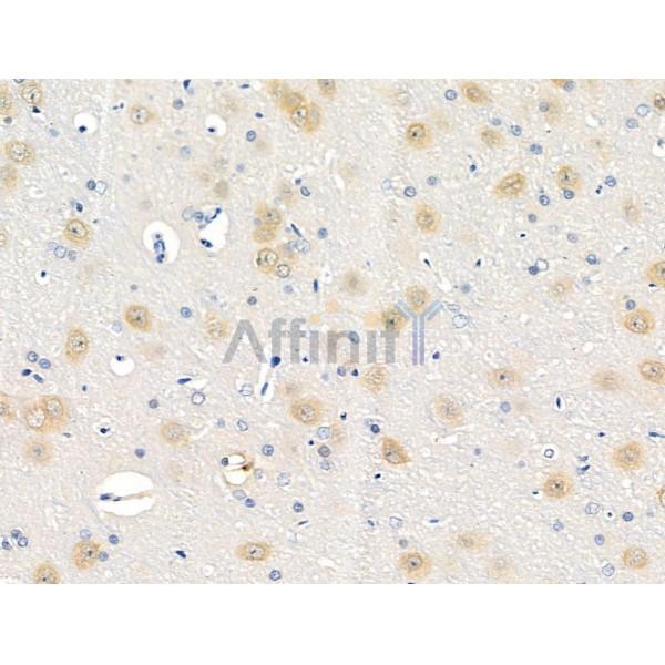 Phospho-PAK1 /PAK2 (Ser199/Ser204, Ser192/Ser197) Antibody - AF2380 at 1/100 staining Rat brain tissue by IHC-P.