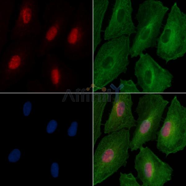 Phospho-FOXL2 (Ser263) Antibody - AF3649 staining A549 cells(4h of LPS treatment) by IF/ICC.