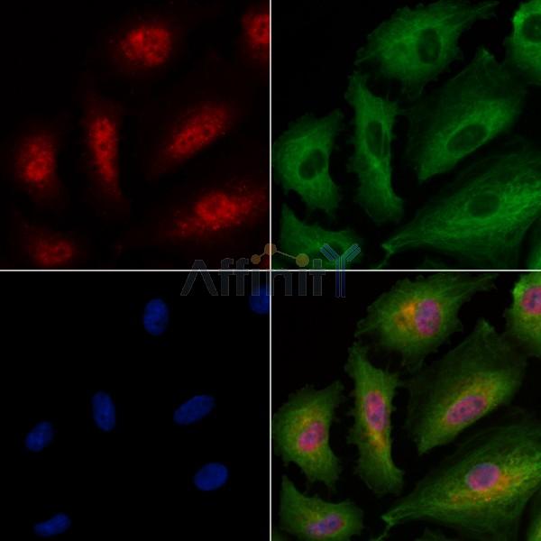Phospho-RSK2 (Ser386) Antibody - AF3655 staining A549 cells(4h of LPS treatment) by IF/ICC.
